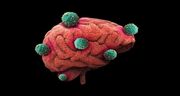 آنچه درباره تومور مغزی باید بدانید