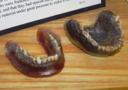 عجیب ترین دندان مصنوعی جهان (+عکس)