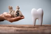 رئیس جامعه دندانپزشکی ایران : هزینه‌های دندانپزشکی گران نیست ؛ درآمد مردم کم است