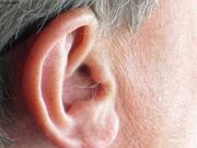 مو روی لاله گوش علامت بیماری است؟