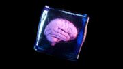 سرمازیستی ؛ ماجرای واقعی مغز یک پزشک که شبیه فیلم های علمی تخیلی است! (+عکس)