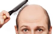 شناسایی ژن‌های نادر عامل ریزش موی مردان
