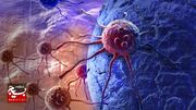 استفاده از نانوذرات در درمان سرطان ریه