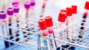 دانشمندان می‌توانندویروس اچ‌آی‌وی راازسلول‌های آلوده جداکنند