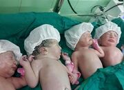 تولد پنج قلوها و چهار قلوها در یک بیمارستان