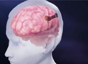 رقیب نورالینک رکورد ایمپلنت الکترود را در مغز شکست - اکونیوز