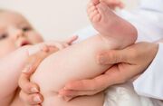 بیماری های مادرزادی شایع و نادر ارتوپدی اطفال - اکونیوز