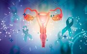 افزایش ۴ برابری احتمال سرطان تخمدان در زنان مبتلا به اندومتریوز