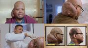 (ویدئو) عمل جراحی مرد هیولایی؛ پرستار از بوی گند تومور بیهوش شد!