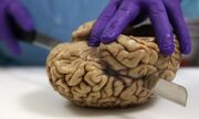 جزئی‌ترین تصویر از مغز انسان که تابه‌حال دیده‌اید!