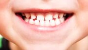 اولین داروی رشد مجدد دندان وارد فاز آزمایش انسانی می‌شود