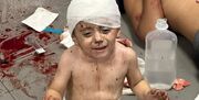 بیش از 1000 شهید و زخمی فلسطینی در حمله صهیونیست‌ها به بیمارستان غزه