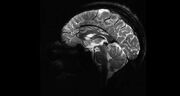 تصاویر خیره‌کننده مغز انسان در قوی‌ ترین دستگاه MRI جهان