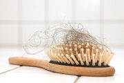 علت ریزش مو در زنان کمبود چه ویتامینی است ؟ | دلایل ریزش مو در زنان