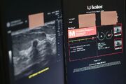 آیا هوش مصنوعی می‌تواند عکس‌های رادیولوژی بیماران را تفسیر کند؟