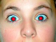 آیا از قرمزی مردمک چشم در عکس‌ها باید نگران شویم؟