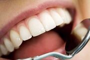 «سلامت دهان و دندان» ضامن تقویت سلامتی قسمت‌های مختلف بدن