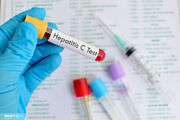 کیت تشخیصی سریع هپاتیت در تمام معاونت‌های بهداشتی کشور به اندازه کافی توزیع شده است