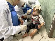 رنج روزافزون کودکان غزه از سوء تغذیه