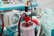 سامانه‌های جدا سازی سلول‌های خون از پلاسما، دستاورد محققان ایرانی