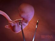 مرکز نفس خمین ۱۲ جنین را از سقط نجات داد