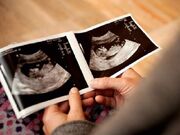 جلوگیری از ۴۷۶ سقط جنین سالم در خراسان رضوی