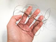 روش‌های پیشگیری و قطع ریزش موی سر، ابرو و مژه