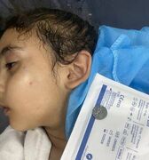 کودک اهل غزه که از سر گرسنگی باتری ساعت بلعیده بود