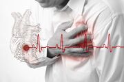 فیبریلاسیون دهلیزی عامل زمینه‌ساز قوی برای نارسایی قلبی است