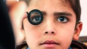 «تنبلی چشم» شایع‌ترین علت نابینایی یک چشمی