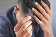 درمان جدید برای رویش مجدد موی بیماران خودایمنی