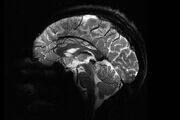 رونمایی از نخستین تصاویر مغزی ثبت‌شده توسط قوی‌ترین دستگاه MRI جهان / قدرتی فراتر از تصور