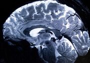 قدرتمندترین "ام‌ آر آی" جهان تصاویر مغز انسان را اسکن کرد