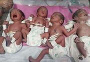 تولد چهارقلوهای مشهدی در هفته ۳۳ بارداری + فیلم