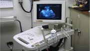 دومین دستگاه سونوگرافی پرتابل در بیمارستان دارالشفاء میرجاوه راه‌اندازی شد