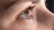 مالیدن چشم خصوصا در دوران بلوغ منجر به قوز قرنیه می‌شود
مالیدن چشم خصوصا در دوران بلوغ منجر به قوز قرنیه می‌شود