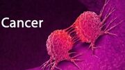 ۳۰ تا ۵۰ درصد سرطان‌ها قابل پیشگیری است