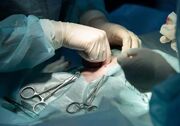 نجات جان مادر و جنین‌های دوقلو در هفته ۳۱ بارداری با جراحی کم‌تهاجمی