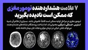 ۷ علامت هشداردهنده تومور مغزی که ممکن است نادیده بگیرید(اینفوگرافیک)