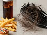 اگر این ۵ خوراکی در رژیمتان است، منتظر کچلی باشید!