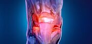 آرتروز دیگر بیماریِ سنین بالا نیست؛ زنگ خطر درد و ناتوانیِ زودرس برای جوانان