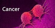 ۳۰ تا ۵۰ درصد سرطان‌ها قابل پیشگیری است / مردم به پیشگیری توجه کنند