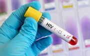 HIV؛ بیماری عفونی و قابل کنترل