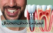 ایمپلنت دیجیتال چیست؟ مزایا، معایب و حقایقی که باید بدانید