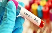 سن ابتلا به سرطان‌ها در کشور پایین آمده