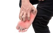 خارش کف‌پا؛مشکل کوچک یا نشانه‌بیماری جدی؟