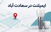 ایمپلنت دندان در سعادت آباد