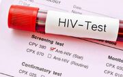 هشدار درباره تغییر الگوی انتقال HIV