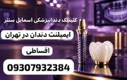 در انتخاب خدمات دندانپزشکی و درمان ریشه به چه نکاتی باید توجه کنیم؟