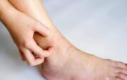 خارش قوزک پا؛ علت چیست